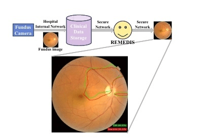 파이헬스케어, 다질환 판별 '망막 AI 진단 프레임워크' 국제 학술지 등... - 뉴스 썸네일 이미지